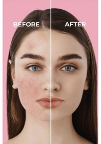 Resim Sinoz Pink Touch Yüksek Koruyucu Ton Eşitleyici Pembe Yüz Güneş Kremi SPF50+ 50 ML 