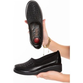 Resim Artı-artı001-1918 Ortopedik Topuk Dikeni Detaylı Kadın Siyah Bağsız Ayakkabı 001 