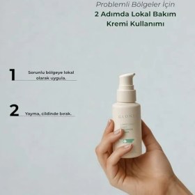 Resim Glone Çinko Oksitli Sos Onarıcı KREM,50ML - Pişik, Tahriş ve Kızarıklık Için Yatıştırıcı Bariyer Bakımı 
