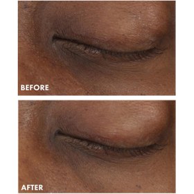 Resim Origins GinZing Aydınlatıcı Göz Kremi - 15 ml • C Vitamini + Niasinamid ile koyu halkalara karşı -orginal 