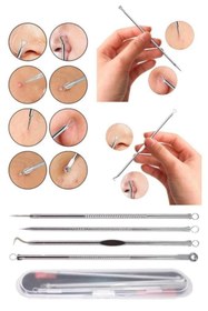 Resim SETBEAUTY Paslanmaz Çelik Siyah Nokta Akne Sivilce Temizleme Aleti 