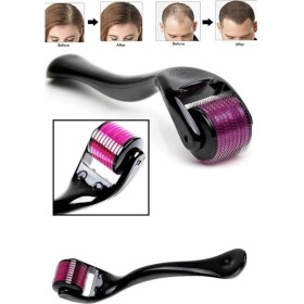 Resim MCM Group Derma Roller Titanyum Uçlu 540 Iğneli 1 mm Saç Sakal Çıkarma ve Cilt Bakım Masaj Aleti 