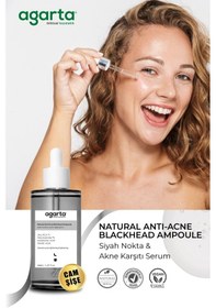 Resim Agarta Siyah Nokta ve Akne Karşıtı Serum 50 ML 