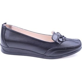 Resim Norfix 101 Kadın Ortopedik Anne Ayakkabısı 001 