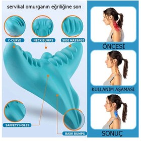 Resim Boyun Hörgücü Ve Kamburluk Önleyen Ortopedik Yastık | Dik Duruş, Sağlıklı Omurga Ve Rahat Uyku Desteği 