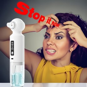 Resim 6’lı 1 Arada Elektrikli Siyah Nokta Cihazı, USB Şarjlı Sıcak Kompres Güzellik Aleti, 6 Değiştirilebilir Temizleme Başlığı, Kir ve Kirlilikleri Derinlemesine Temizler, Yüz Vakum Bakımı ve Masaj Siyah Nokta Cihazı, Ev Kullanımı İçin Mükemmel Hediye 