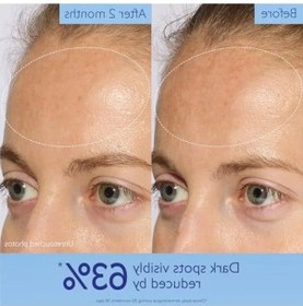 Resim 30 Ml Işıltı Verici Leke Karşıtı Serum 