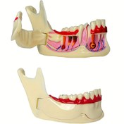 Resim Diş Profesyonelleri, Hijyenistler ve Öğrenciler için Ağız Boşlukları & Kök Kistikleri ile Diş Alt Çenesi Anatomi Modeli - Plastik Diş Gösterim Aracı 