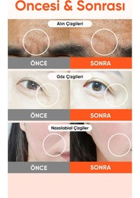 Resim Retinol Ve Pdrn Mikro İğneli Göz Altı Ve Nazolabial Çizgi Reti-rn Microcone Patch Slim 6 Lı 