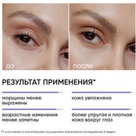 Resim Icon Skin AGE ERASER %0.05 Retinol İçerikli Yaşlanma Karşıtı Göz Çevresi Bakım Kremi 20 ml 