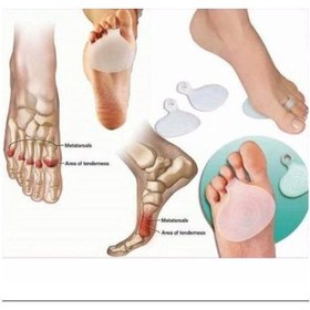 Resim Ayak Pedi Ayak Altı Nasır Ped Silikon Halkalı Metatarsal Standart 