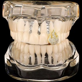 Resim RICH ONE AND ONLY GRILLZ NO.6 (Ön Sipariş) 