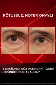 Resim L'Oreal Paris Revitalift Lazer Eyebag Instant Eraser Göz Altı Torba Görünümüne Karşı Etkili Göz Kremi 15ml 