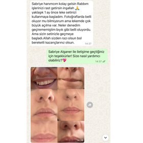 Resim Sabral Leke Karşıtı Aydınlatıcı Set 