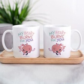 Resim Kalbim Senin İçin Yanıyor Sevgili Kupası 