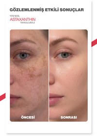 Resim Dr.Melaxin Leke Karşıtı Jel Serum | Tranexamic + Astaxanthin + Niacinamide | 3 Etki Tek Formül 30ml 