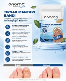 Resim Health Tırnak i Bandı Hidrojel Tırnak Bakımı 12 Adet 