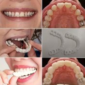 Resim 2 Adet Esnek Beyaz Rahat Ağız Koruyucu, Üst ve Alt Bağlantılı, Unisex Kolay Kullanım Diş Koruma Çözümü, İç Güveni Artırıcı 