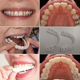 Resim 2 Adet Esnek Beyaz Rahat Ağız Koruyucu, Üst ve Alt Bağlantılı, Unisex Kolay Kullanım Diş Koruma Çözümü, İç Güveni Artırıcı 