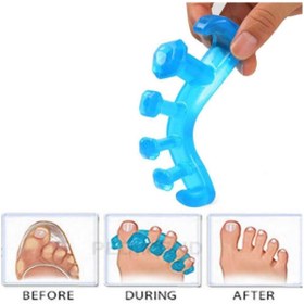 Resim Ayak Parmak Kemik Düzeltici 1. Kalite Halluks Valgus 5 Parmak Ayırıcı 1 Çift 