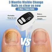 Resim USB Şarj Edilebilir Tırnak Bakım Cihazı - Seyahat için Kompakt Tasarımlı, Dijital Ekranlı Taşınabilir Ayak Rahatlatma Aracı, Erkekler & Kadınlar için İdeal, Lityum Polimer Pil ile Çalışan 