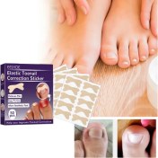 Resim Ttt Ayak Tırnağı Düzeltme Bandı 50 Adet 