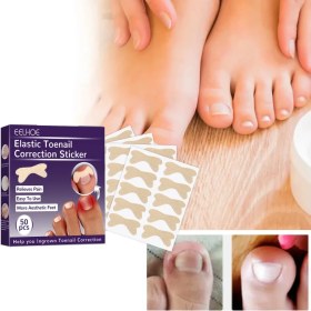 Resim Ttt Ayak Tırnağı Düzeltme Bandı 50 Adet 