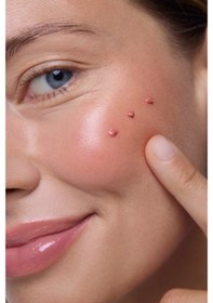 Resim Babe Lip&Cheek Balm Pink SPF50 20ml - Dudak ve Yanak Balmı 