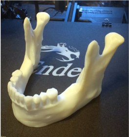 Resim 3dbaskisepeti Diş Çene Tablet Ve Telefon Stand 