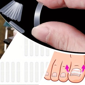 Resim Taşınabilir Elastik Tırnak Yama Aracı - Saklamak ve Taşımak Kolay, Dayanıklı Plastik Tasarım, Tırnak Bakımı İçin Uygun, Ev ve Seyahat Dostu, Kullanımı Rahat, Tırnak Bakım Kiti, Kompakt Tasarım 