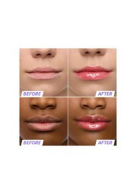 Resim Wonderskin Lip Rehab Nemlendirici Ve Onarıcı Renkli Dudak Serumu Yağı Amour 3.57ml 