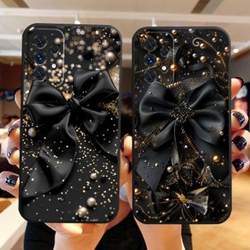 Resim Samsung Galaxy A56/A55/A54/A53/A52S/A52/A35/A34/A33/A32/A25/A24/A23/A22/A16/A15/A14/A13/A06/A05S/A05/A04S/A04/S25Plus/S25/S24FE/S24Plus/S24/S23FE/S23+/S23/S22+/S22/S21FE/S21+/S21 Ultra 5G için Telefon Kılıfı Parlayan Sevimli Güzel Havalı[WA3637] 