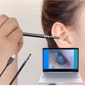 Resim Kulak Temizleme Aracı Kaşık Hd Kamera Aracı Usb Tipi C Soket Win 