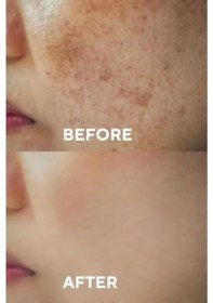 Resim The Ceel Leke Karşıtı Ve Cilt Tonu Eşitleyen Cilt Serumu, Glutatyon & Niacinamide Etkili 30 Ml 