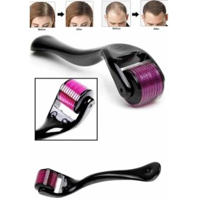 Resim MCM Group Derma Roller Titanyum Uçlu 540 Iğneli 1 mm Saç Sakal Çıkarma ve Cilt Bakım Masaj Aleti 