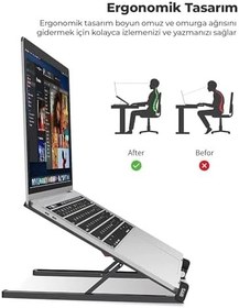 Resim Bix Saiji X2 Taşıma Çantalı Alüminyum Notebook Laptop Standı Gümüş 