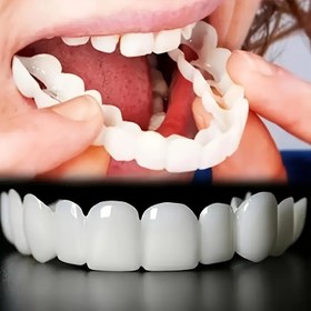 Resim 2 Adet Esnek Beyaz Rahat Diş Koruyucu Üst ve Alt Aksesuarlı, Kolay Giyilen Uniseks Diş Koruma Çözümü ile Artan Özgüven 