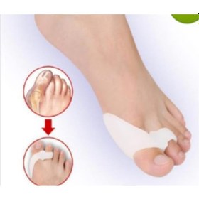 Resim Silikon Ayak Parmak Kemik Halluksvalgus Bunyon Koruyucu 