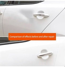 Resim Novahub Araç Gövde Onarımları İçin 18 Adet Ped Set, Vantuz Ve Tutkal Kazıyıcı 