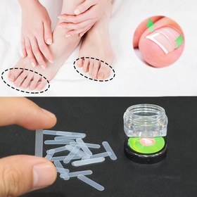 Resim 24 Adet İçe Doğru Büzülen Tırnaklar için Ayak Bantları - Parmak ve Başparmaklar, Ayak Bakımı ve Ev Kullanımı İçin Uygun, Kolay Kullanım, Taşıması Pratik 