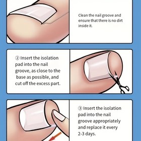 Resim Zırhlı Batık Tırnak Kiti -10/20/31/41/50/100 Adet Ayak Araçları ve Ayak Araçları 