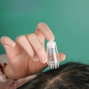 Resim One Scalp Roller Uygulayıcısı - Esansiyel Yağ Enjeksiyonlu Masaj Topu, 2 Renk Mevcut, Esansiyel Yağlarla Kullanılabilir, Kokusuz, Manuel Baş Masajı Öğesi, Elektriksiz Saç Bakım Aracı 