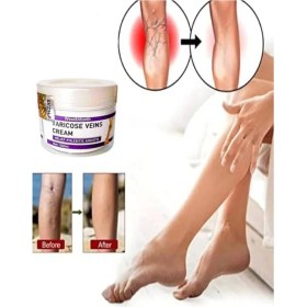 Resim Buğz West & Month Varicose Vein Var.is Karşıtı Masaj Bakım Kremi 100 ml 