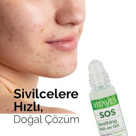 Resim SOS Sivilce Siyah Nokta Akne Sinek Isırması Cilt Problemi Lekeye Karşı Onarıcı Sos Çay Ağacı Serumu 10ml 