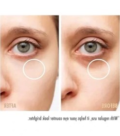 Resim 30 ml Göz Çevresi Için Kafein Içeren Serum 