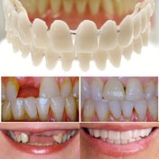Resim 2 adet Gelişmiş Çift Set Sahte Diş Modelleri - Güvenli Reçine, Dayanıklı ve Esnek, Yetişkinler için İdeal - Profesyonel Kullanım, Profesyonel Diş Seti|Doğal Görünümlü Dişler|Dayanıklı Diş Modeli, Diş Beyazlatma 