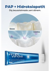Resim Probiwhite Beyazlatıcı Diş Macunu-pap Teknolojili,mikro Hidroksiapatit+enzim ,vegan Beyazlatma 