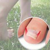 Resim Gözellerinizi daha iyi gösterin! İçe doğru büyüyen tırnaklar için ayak bakım ve tırnak bakımı araçları. Kutulu tırnak çıkartmaları ve tırnak aletleri, parmaklar ve başparmaklar için uygundur 