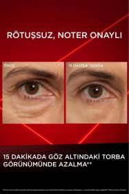 Resim L'Oréal Paris Revitalift Lazer Eyebag Instant Eraser Göz Altı Torba Görünümüne Karşı Etkili Göz Kremi 15 ML 
