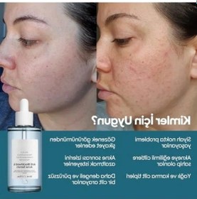 Resim Gözenek Sıkılaştırıcı Niacinamide Yüz Serumu, 50 Ml 